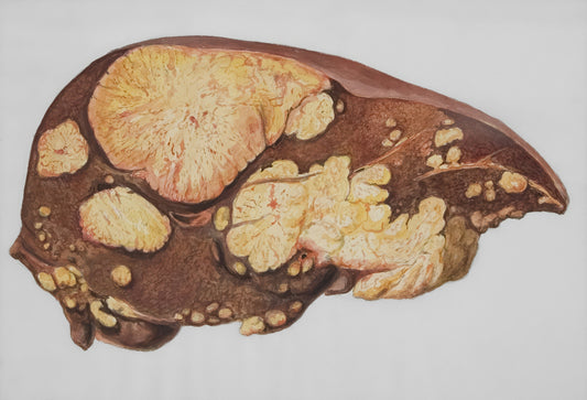 What Toxins Does Your Liver Actually Remove?